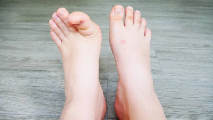 La clinique podiatrique à Aylmer : des soins pour vos pieds